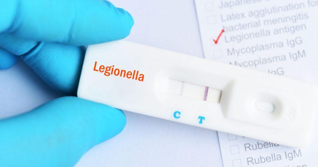 Test della Legionella